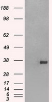 CD32A (FCGR2A) antibody