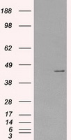 Protein Kinase A regulatory subunit I alpha (PRKAR1A) antibody