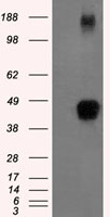 Tristetraprolin Antibody
