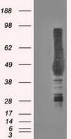 Carbonic Anhydrase IX (CA9) antibody