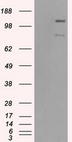 BubR1 (BUB1B) antibody
