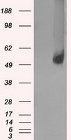 Glucose Transporter 5 GLUT5 Antibody