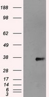 NEK6 Antibody