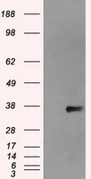 NEK6 antibody