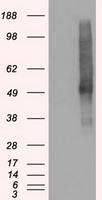 VMAT2 (SLC18A2) antibody