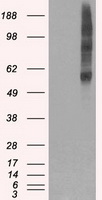 VMAT2 (SLC18A2) antibody