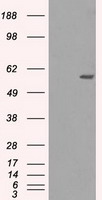 MADM (NRBP1) antibody