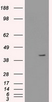 Cytokeratin 19 (KRT19) antibody