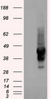 alpha 1 Antitrypsin (SERPINA1) antibody