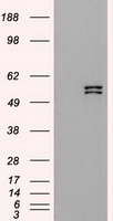 Cytokeratin 8 (KRT8) antibody