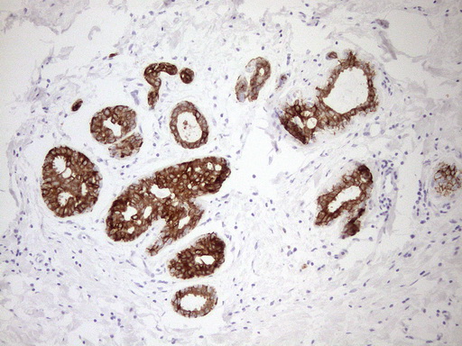 pan Cytokeratin antibody