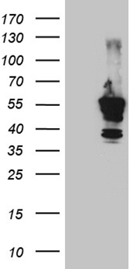 Carrier-free (BSA/glycerol-free) tdTomato antibody