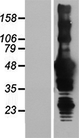 Trim72 Mouse Over-expression Lysate