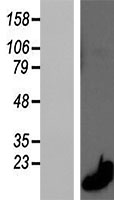 Calprotectin (S100a8) Mouse Over-expression Lysate