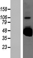 B4galt2 Mouse Over-expression Lysate