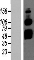 B4galt1 Mouse Over-expression Lysate