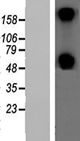 B4galt6 Mouse Over-expression Lysate