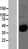 B4galt7 Mouse Over-expression Lysate