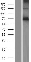 PODN Human Over-expression Lysate