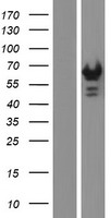 Sterol carrier protein 2 (SCP2) Human Over-expression Lysate