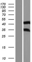 ANKRD63 Human Over-expression Lysate