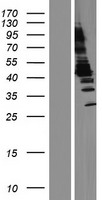 Aminoacylase 1 (ACY1) Human Over-expression Lysate