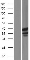 TSPY1 Human Over-expression Lysate