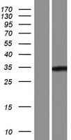 LRRC72 Human Over-expression Lysate