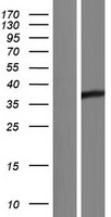 AKR1D1 Human Over-expression Lysate