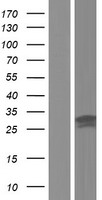 DCXR Human Over-expression Lysate