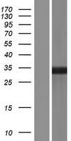 HLA-DQB2 Human Over-expression Lysate