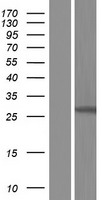 GSTO2 Human Over-expression Lysate