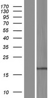RPP21 Human Over-expression Lysate