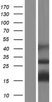 CENPS-CORT Human Over-expression Lysate