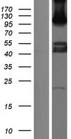 SEMA6C Human Over-expression Lysate
