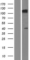 SEZ6L Human Over-expression Lysate