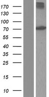 ACOX1 Human Over-expression Lysate