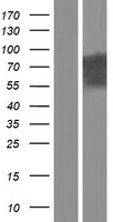 EFHC1 Human Over-expression Lysate