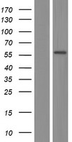 PGM1 Human Over-expression Lysate