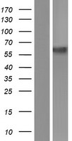 DMT1 (SLC11A2) Human Over-expression Lysate