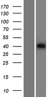 p53R2 (RRM2B) Human Over-expression Lysate