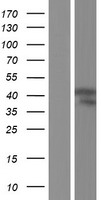 ADH7 Human Over-expression Lysate