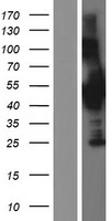 CCM2 Human Over-expression Lysate