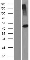 PHKG2 Human Over-expression Lysate