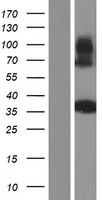 TSFM Human Over-expression Lysate
