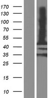 MAGEA12 Human Over-expression Lysate