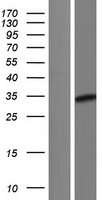 CITED2 Human Over-expression Lysate
