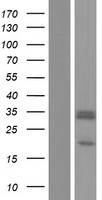 SCO2 Human Over-expression Lysate