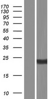 CD8B Human Over-expression Lysate