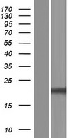 NUDT16 Human Over-expression Lysate